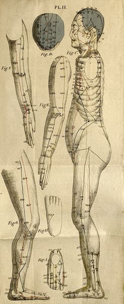 ,Jean-Baptiste Sarlandière : M�moires sur l'�lectro-puncture, traiter la goutte, les rhumatismes et les affections nerveuses  - Asta Libri, Autografi e Stampe - Associazione Nazionale - Case d'Asta italiane