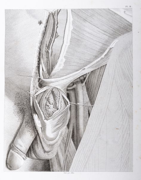 ,Antonio Scarpa : Trait� pratique des Hernies  - Asta Libri, Autografi e Stampe - Associazione Nazionale - Case d'Asta italiane