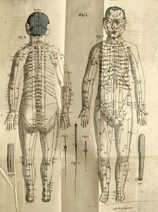 ,Jean-Baptiste Sarlandière : M�moires sur l'�lectro-puncture, traiter la goutte, les rhumatismes et les affections nerveuses  - Asta Libri, Autografi e Stampe - Associazione Nazionale - Case d'Asta italiane