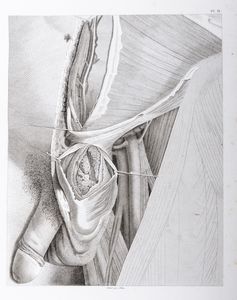 ,Antonio Scarpa - Trait� pratique des Hernies