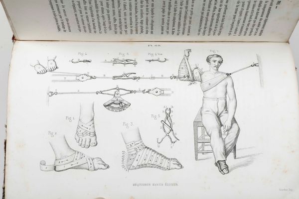 Samuel Auguste André David Tissot : Del morbo negro dissertazione del Signor Tissot, Dottor di Medicina di Monpellier, della Societ� Reale di Londra, dell�Accademia Medico-Fisica di Basileae della Societ� di Economia di Berna...In Venezia, appresso Giovanni Gatti, 1784  - Asta Libri Antichi e Rari. Incisioni - Associazione Nazionale - Case d'Asta italiane