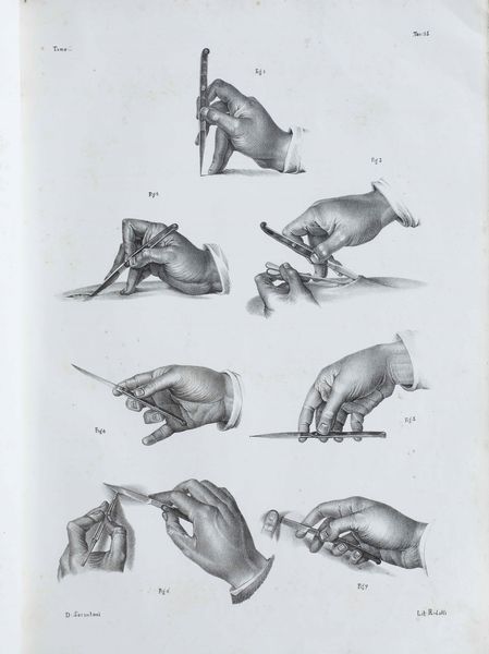 Bourgery, Jean Baptiste Marc Raccolta di tavole  litografiche in nero, tratte dal trattato di anatomia chirurgica operativa.Firenze, Met secolo XIX.  - Asta Libri Antichi e Rari. Incisioni - Associazione Nazionale - Case d'Asta italiane