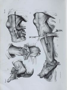 Bourgery, Jean Baptiste Marc Raccolta di tavole  litografiche in nero, tratte dal trattato di anatomia chirurgica operativa.Firenze, Met secolo XIX.  - Asta Libri Antichi e Rari. Incisioni - Associazione Nazionale - Case d'Asta italiane