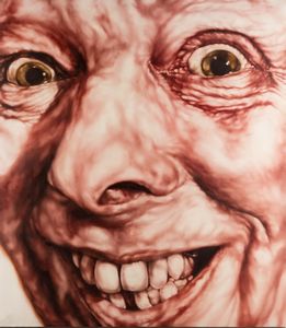 Alessandro Bellucco - Ipertrofie