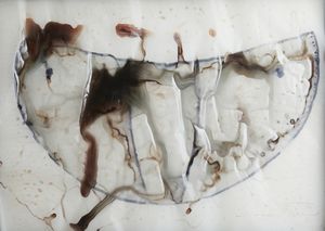 ASTORE SALVATORE (n. 1957) - Anatomia vascolare.