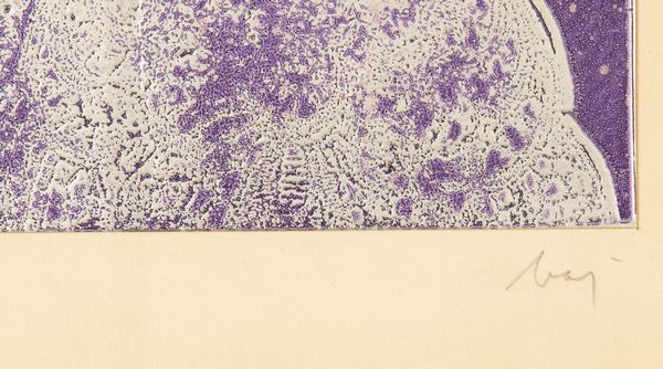 ENRICO BAJ : Jackie dans une robe de Paco Rabanne  - Asta Prints and Multiples - Associazione Nazionale - Case d'Asta italiane