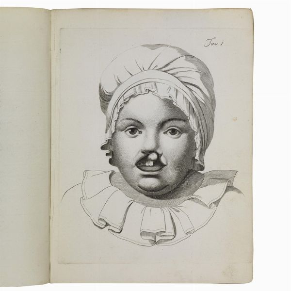 (Medicina - Illustrati 700)   SONSIS, Giuseppe.   Memoria chirurgica sul labbro leporino complicato.   Cremona, Giuseppe Feraboli, 1793.  - Asta LIBRI, MANOSCRITTI E AUTOGRAFI - Associazione Nazionale - Case d'Asta italiane