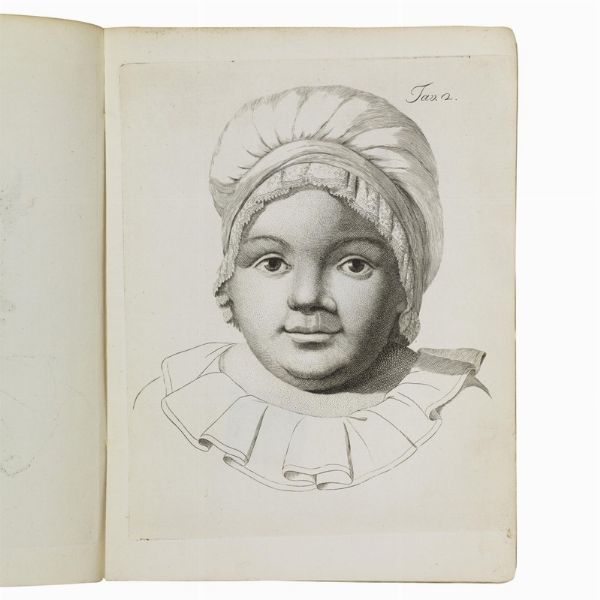 (Medicina - Illustrati 700)   SONSIS, Giuseppe.   Memoria chirurgica sul labbro leporino complicato.   Cremona, Giuseppe Feraboli, 1793.  - Asta LIBRI, MANOSCRITTI E AUTOGRAFI - Associazione Nazionale - Case d'Asta italiane