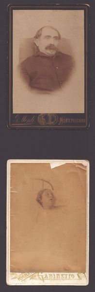 Coppia di carte-de-visite post mortem, ca. 1890  - Asta Opere su carta. Stampe, disegni, foto d'epoca - Associazione Nazionale - Case d'Asta italiane