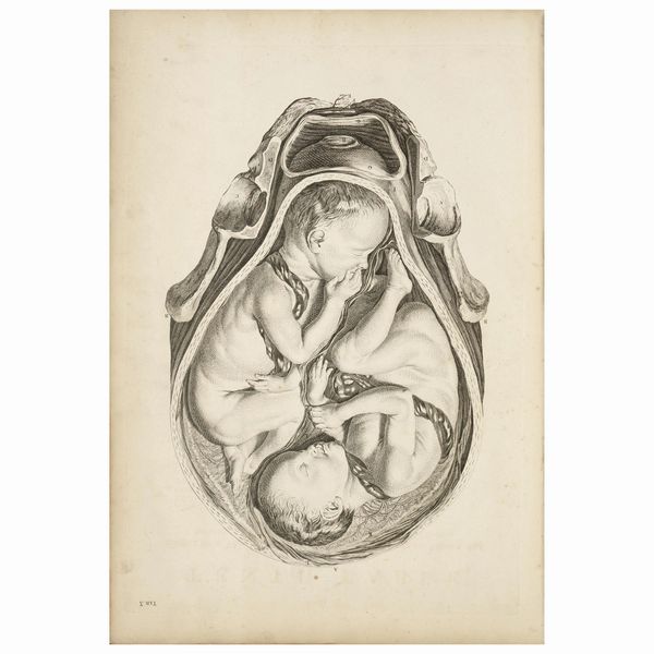 Prima edizione di questo grande classico di ostetricia che si ritiene sia stato stampato in sole 80-100 copie  - Asta LIBRI, MANOSCRITTI E AUTOGRAFI - Associazione Nazionale - Case d'Asta italiane