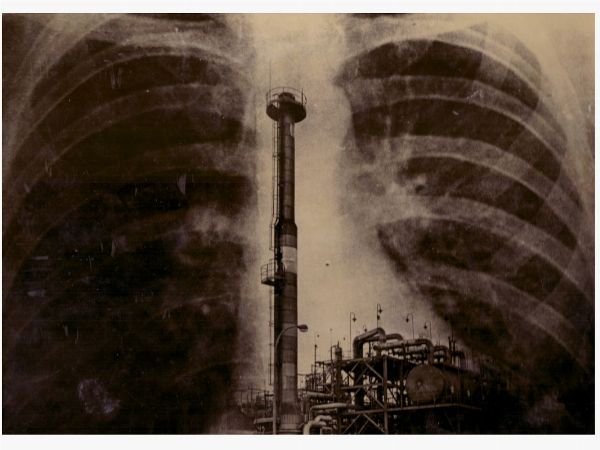 Fabrica y pulmones  - Asta Fotografie tra Ottocento e Novecento - Associazione Nazionale - Case d'Asta italiane
